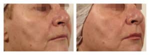trifractional-1